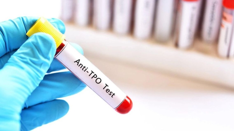 Anti-TPO, Anti-TG và TRAb quan trọng trong đánh giá bệnh tự miễn tuyến giáp