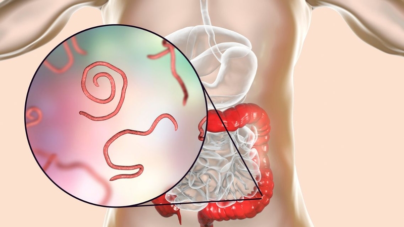 Nhiều người muốn biết xét nghiệm ký sinh trùng có cần nhịn ăn không