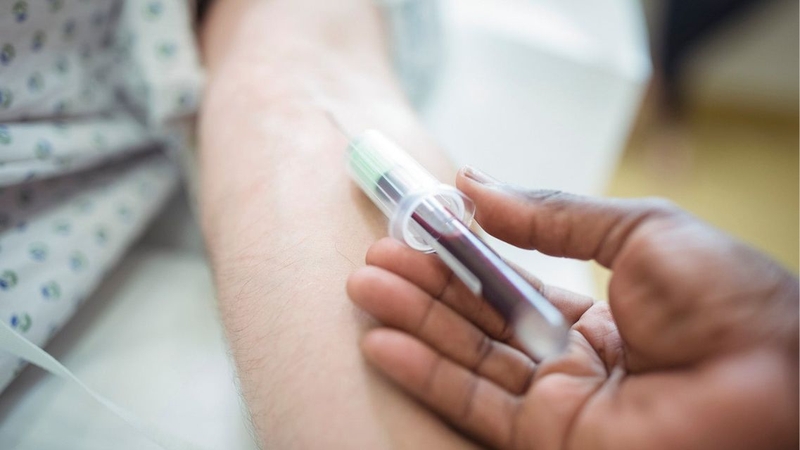 Thực hiện phương pháp xét nghiệm lao nào do bác sĩ chỉ định