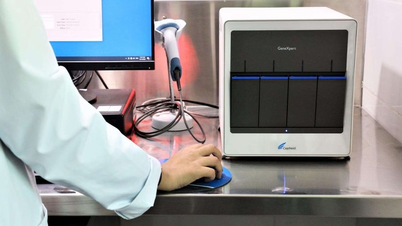 Mỗi phương pháp xét nghiệm có chi phí và thời gian trả kết quả khác nhau