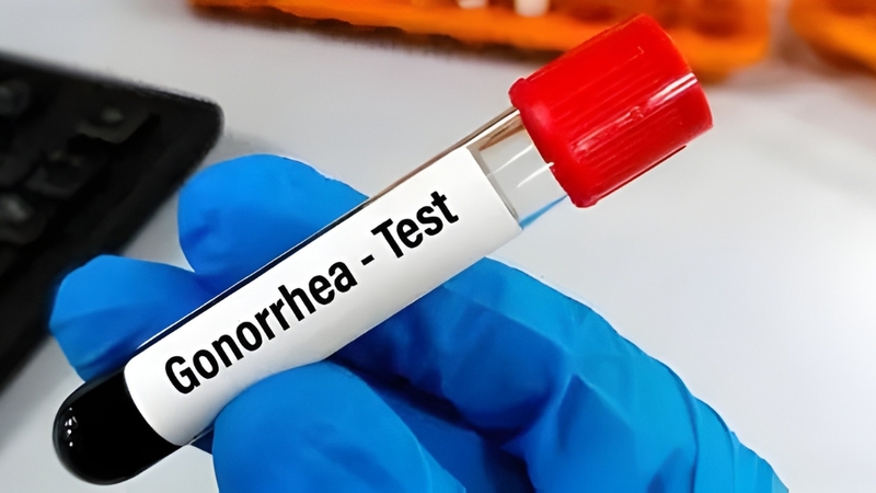 Giải đáp thắc mắc xét nghiệm lậu bao nhiêu tiền