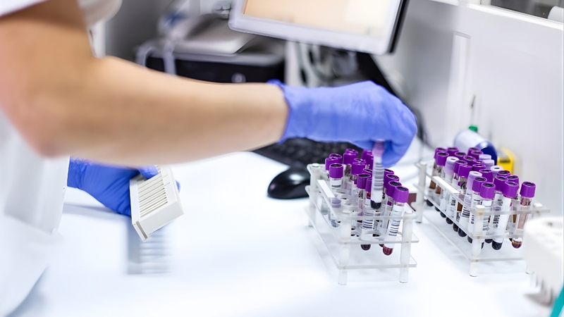 Chi phí xét nghiệm lậu phụ thuộc vào từng phương pháp, mẫu bệnh phẩm và cơ sở thực hiện