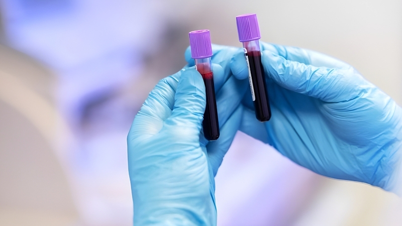 Xét nghiệm lậu sớm giúp phát hiện kịp thời, giảm biến chứng và hạn chế lây nhiễm