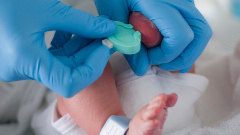Xét nghiệm lấy máu gót chân ở trẻ sơ sinh để làm gì? 1