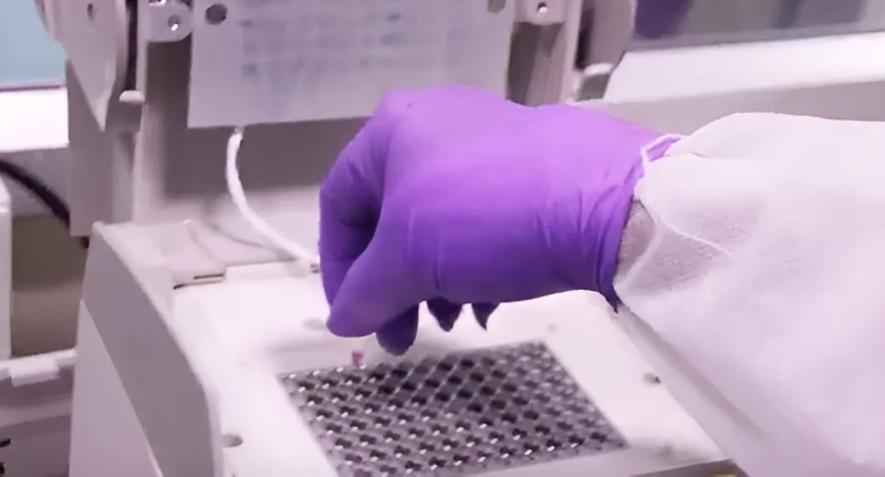 Xét nghiệm LPA là gì? Nó có ưu điểm gì so với các phương pháp khác? 1