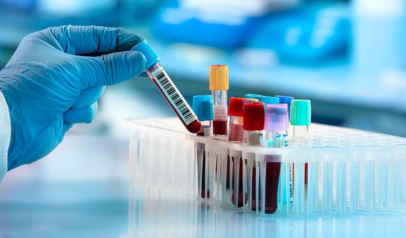 Xét nghiệm máu có biết thiếu canxi không? 2