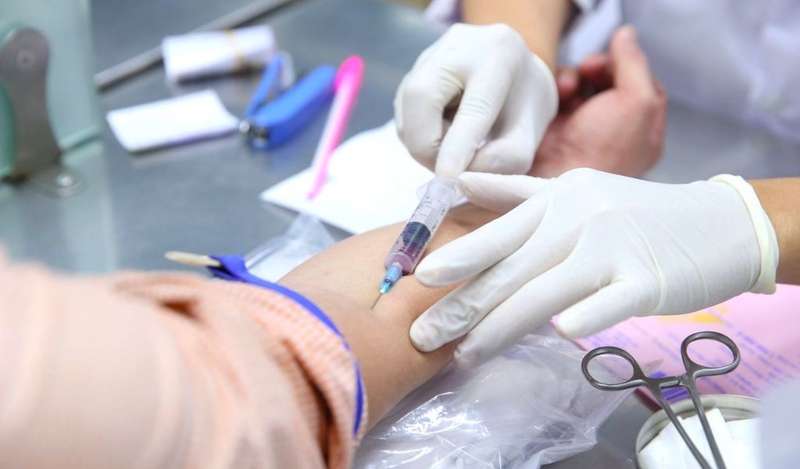 Xét nghiệm máu có biết thiếu canxi không? 1