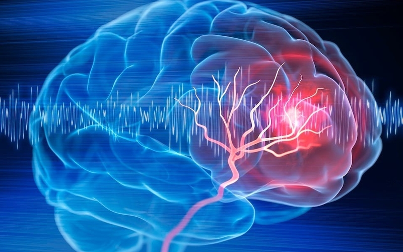 Xét nghiệm máu có biết u não không? 3