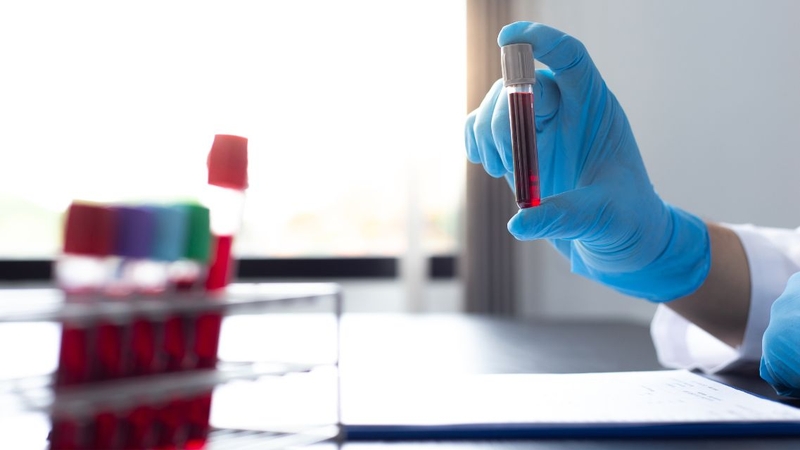 Xét nghiệm máu không phải lúc nào cũng cần nhịn ăn