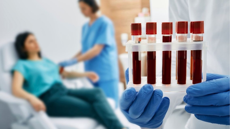 Tìm hiểu kỹ trước khi xét nghiệm máu giúp bạn yên tâm hơn