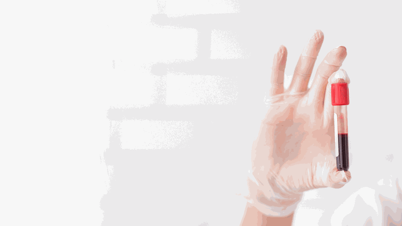 Xét nghiệm máu có được bảo hiểm chi trả không? 3