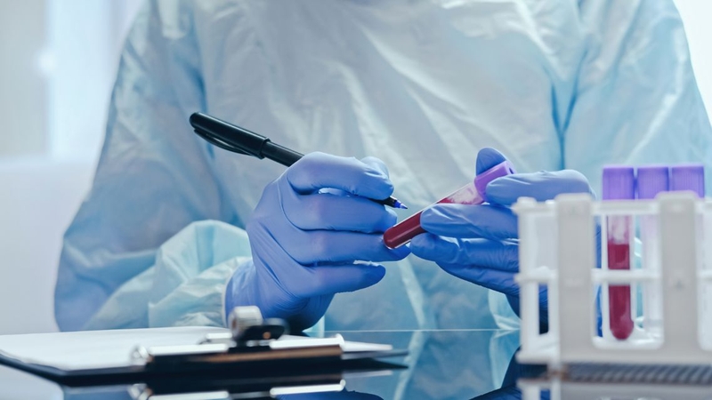 Xét nghiệm máu có phát hiện lao phổi không&nbsp;là thông tin nhiều người muốn biết