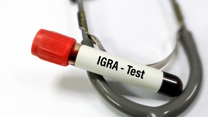 Xét nghiệm máu không chẩn đoán xác định lao phổi nhưng có vai trò hỗ trợ đánh giá bệnh