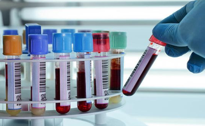 Xét nghiệm máu có phát hiện nghiện ma túy không? 1
