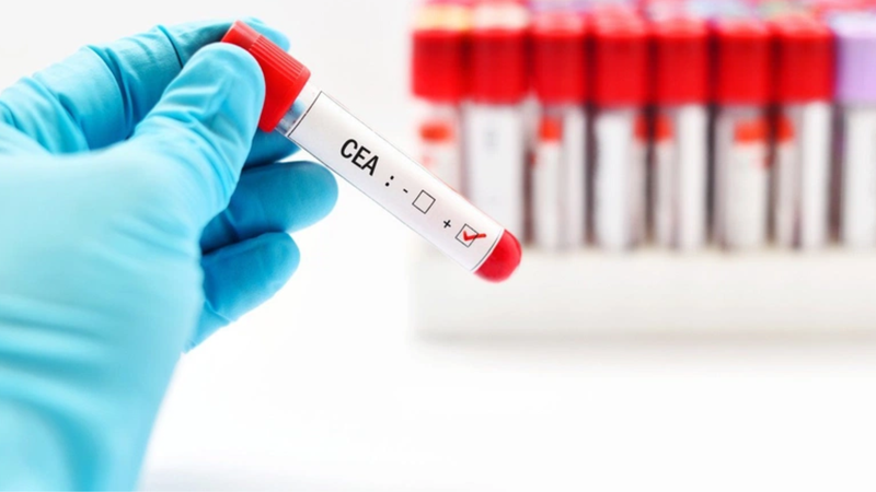 Xét nghiệm máu có phát hiện ung thư cổ tử cung không? 2