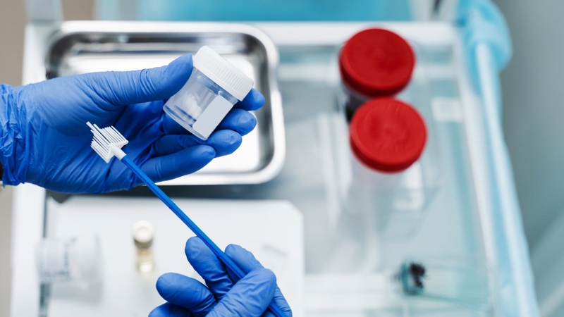 Xét nghiệm máu có phát hiện ung thư cổ tử cung không? Ý nghĩa các chỉ số xét nghiệm 3