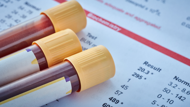 Xét nghiệm máu có thai nhưng siêu âm đầu dò không thấy là vì sao? Nguyên nhân và cách xử trí 1