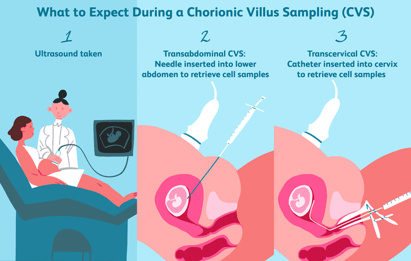 Xét nghiệm máu khi mang thai ở tuần thứ mấy chính xác nhất 3