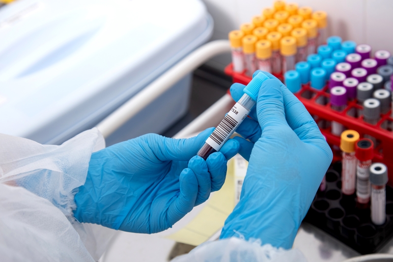 Xét nghiệm máu nhổ răng khôn bao nhiêu tiền - Bạn đã biết chưa? 2