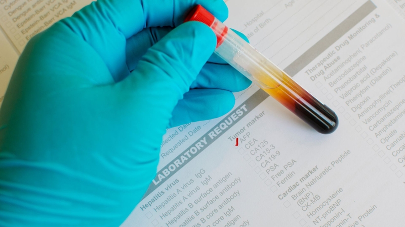 Xét nghiệm máu tổng quát có phát hiện ung thư không? 3