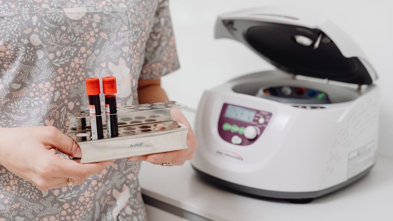 Bạn nên tham khảo chi phí trước khi lựa chọn nơi xét nghiệm máu