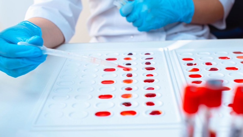 Cần tuân thủ hướng dẫn của bác sĩ khi xét nghiệm máu tổng quát