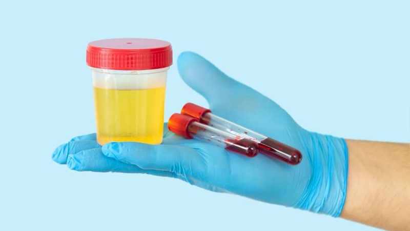 Xét nghiệm máu và nước tiểu giúp bác sĩ đánh giá toàn diện tình trạng sức khỏe