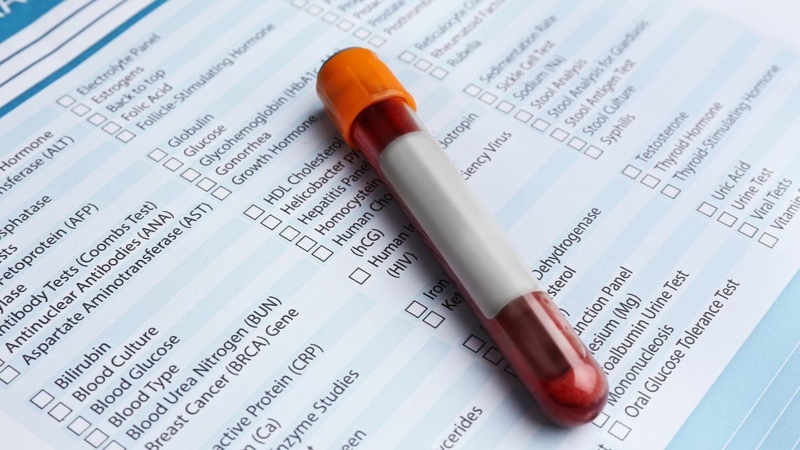 Các chỉ số trong xét nghiệm máu cần phân tích đồng thời