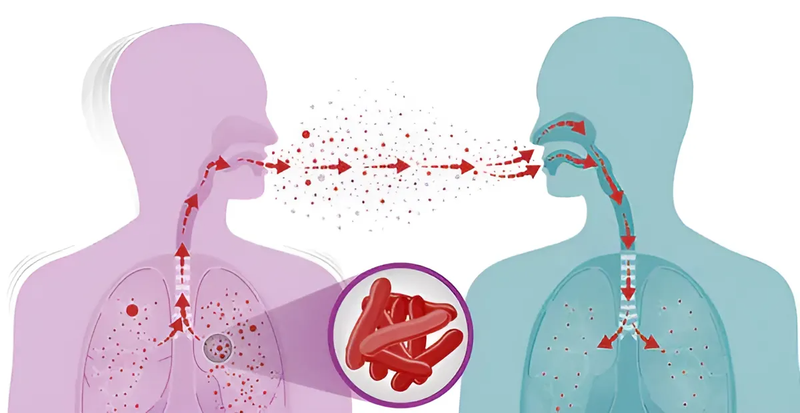 Xét nghiệm MGIT là gì? Ý nghĩa của xét nghiệm MGIT trong việc chẩn đoán bệnh lao 1