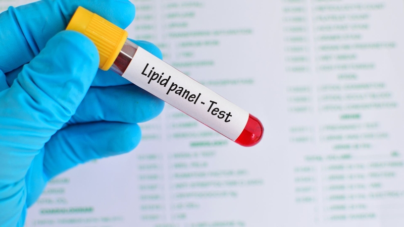 Quy trình xét nghiệm mỡ máu đơn giản nhưng cần chuẩn bị đúng