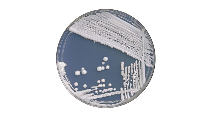 Xét nghiệm nấm Candida: Gồm những gì và khi nào cần thực hiện 2