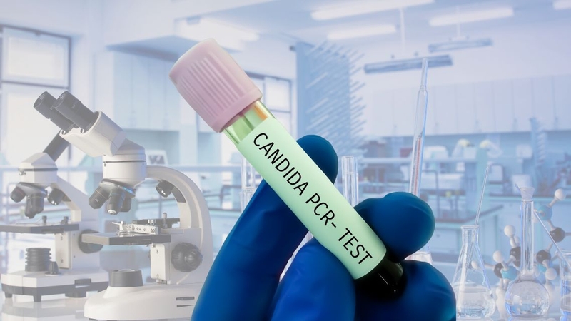 Xét nghiệm nấm Candida: Gồm những gì và khi nào cần thực hiện 3