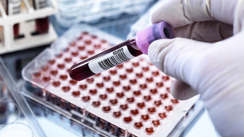 Xét nghiệm nhiễm sắc thể đồ là gì? Quy trình thực hiện xét nghiệm nhiễm sắc thể đồ 3