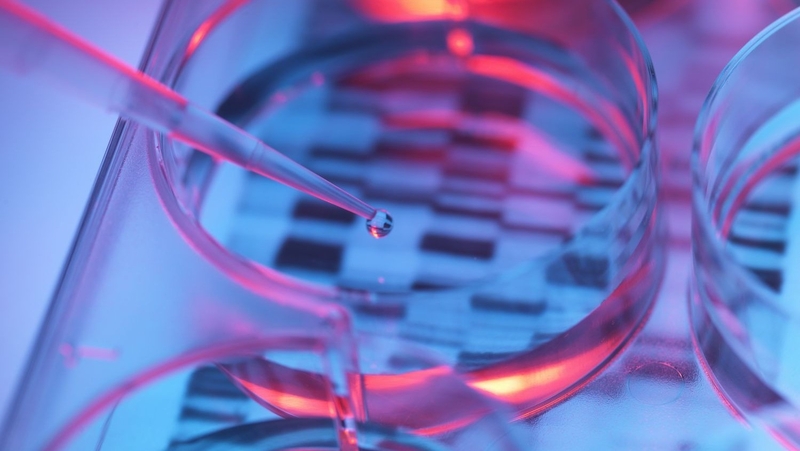 Xét nghiệm nhiễm sắc thể đồ ứng dụng trong y khoa để làm gì? 4