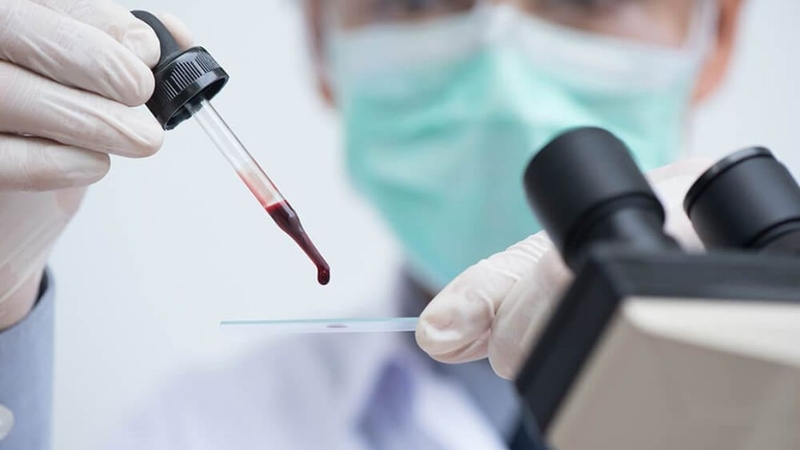 Mỗi phương pháp xác định nhóm máu có ưu điểm và hạn chế riêng