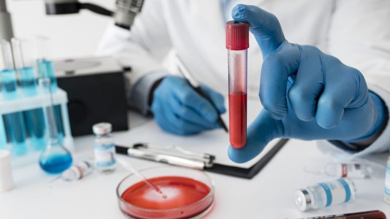 Cách đọc kết quả xét nghiệm xác định nhóm máu khá đơn giản