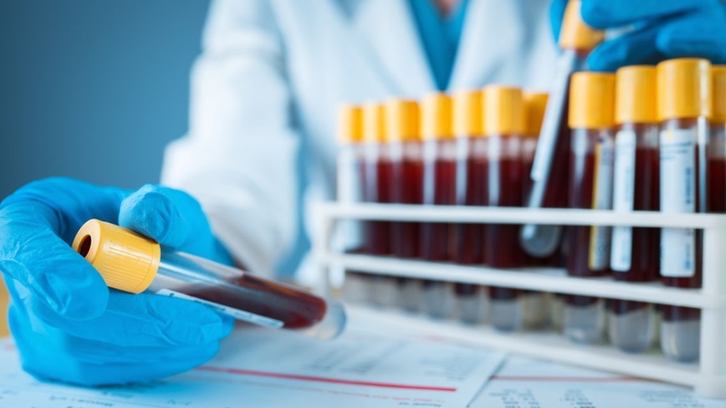 Nhiều trường hợp bác sĩ sẽ chỉ định xét nghiệm nhóm máu