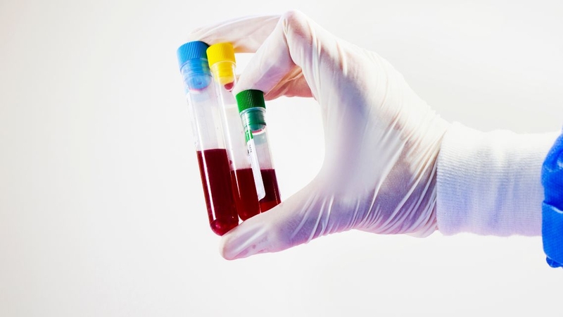 Nên xét nghiệm xác định nhóm máu ở cơ sở y tế uy tín