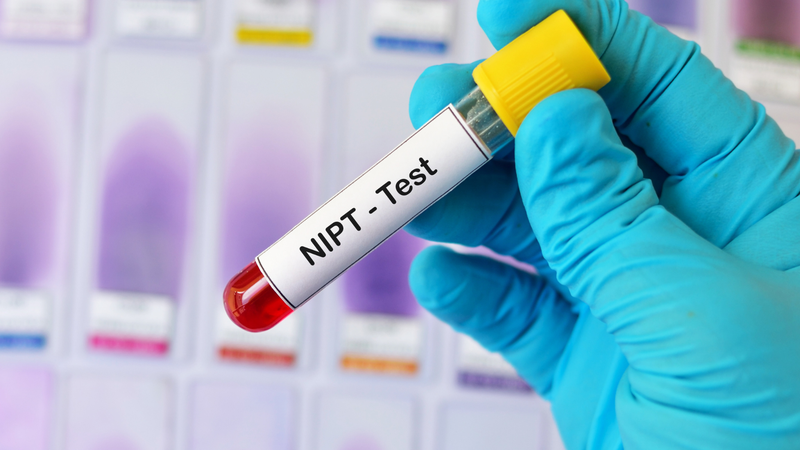 Xét nghiệm NIPT bao lâu có kết quả là thắc mắc của nhiều mẹ bầu