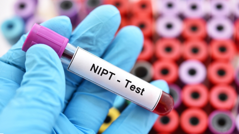 Xét nghiệm NIPT là gì? Biết được những gì và giá làm xét nghiệm? 1