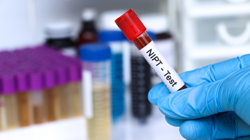 Xét nghiệm NIPT là gì? Biết được những gì và giá làm xét nghiệm? 4