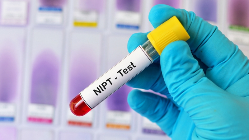 Xét nghiệm NIPT là gì? Biết được những gì và giá làm xét nghiệm? 6