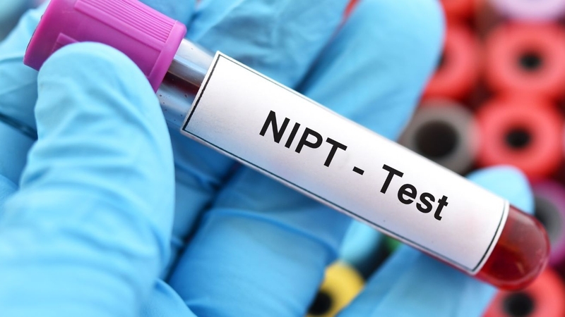 Xét nghiệm NIPT ở đâu - Bạn đã biết chưa? 1