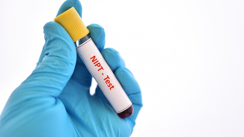 Nên làm xét nghiệm NIPT tại các địa chỉ uy tín tại TPHCM