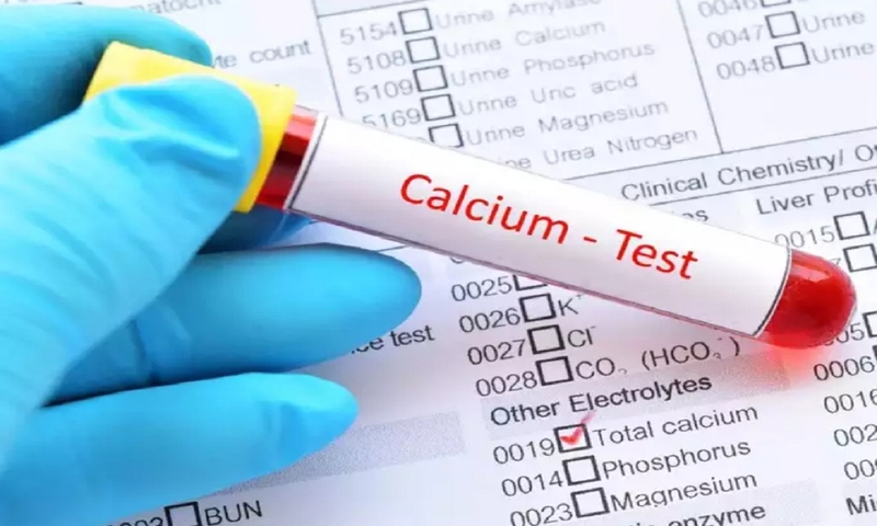 Xét nghiệm nồng độ canxi trong máu là gì? Cách đọc kết quả xét nghiệm 1