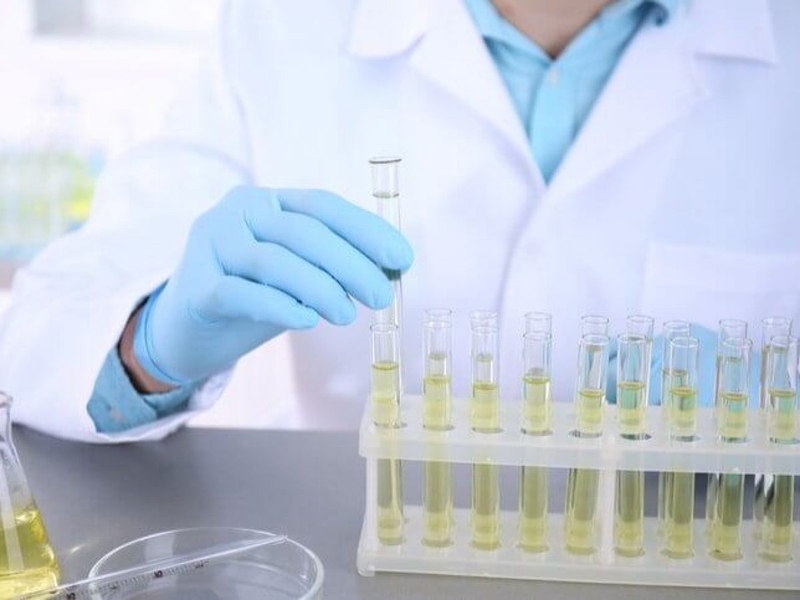 Xét nghiệm nước tiểu biết bệnh gì?2