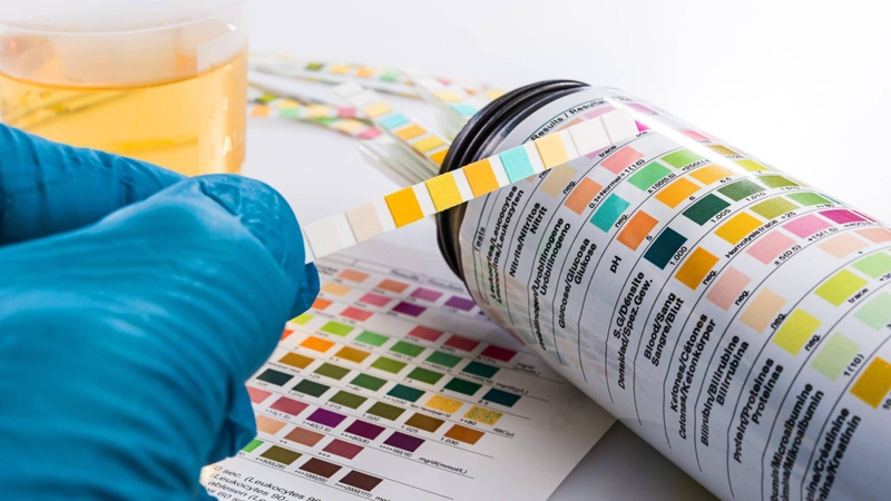 Qua xét nghiệm nước tiểu, thai kỳ được can thiệp kịp thời khi có bất thường