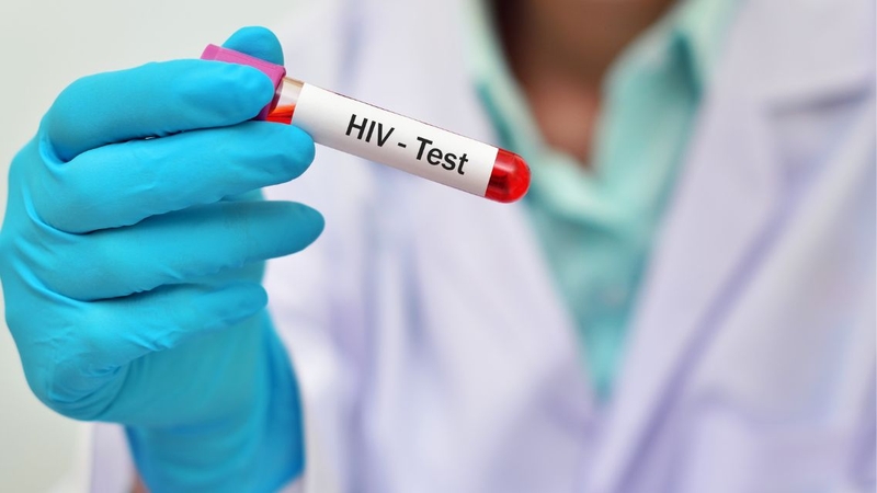 Nhiều người băn khoăn&nbsp;xét nghiệm PCR HIV sau 7 ngày có được không