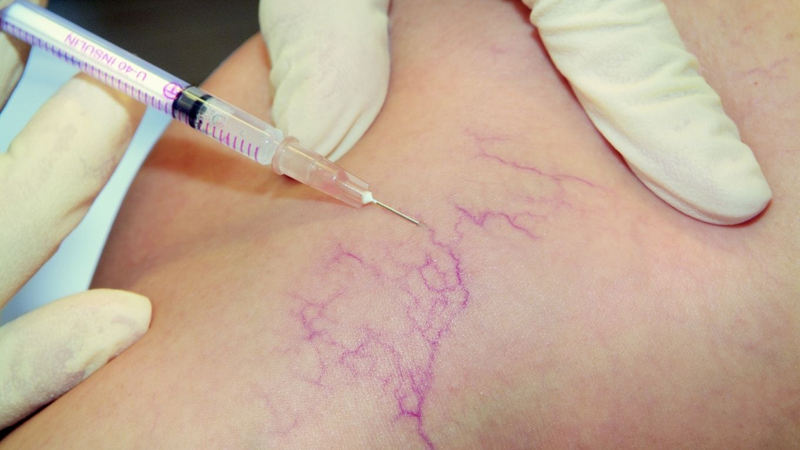 Xét nghiệm PTH và những điều bạn cần biết-3