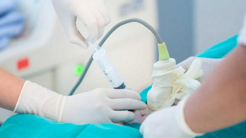 Xét nghiệm QF-PCR là gì? Ý nghĩa của xét nghiệm QF-PCR trước sinh như thế nào?